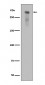 Anti-Phospho-DNA PKcs (S2056) PRKDC Rabbit Monoclonal Antibody
